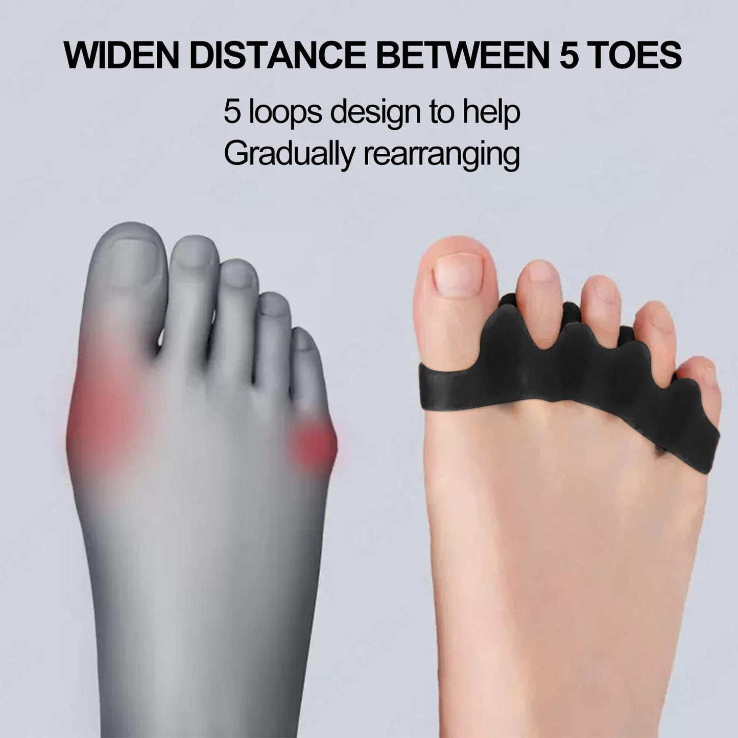 Toe Spacers | Bunion & Foot Pain Relief Splint