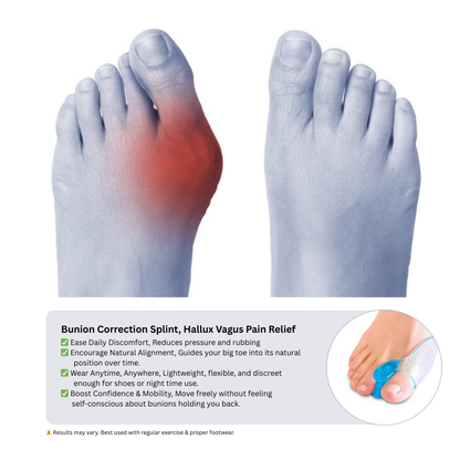 Bunion Correction Splint | Toe Separator Hallux Valgus Pain Relief