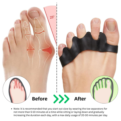 Toe Spacers | Bunion & Foot Pain Relief Splint